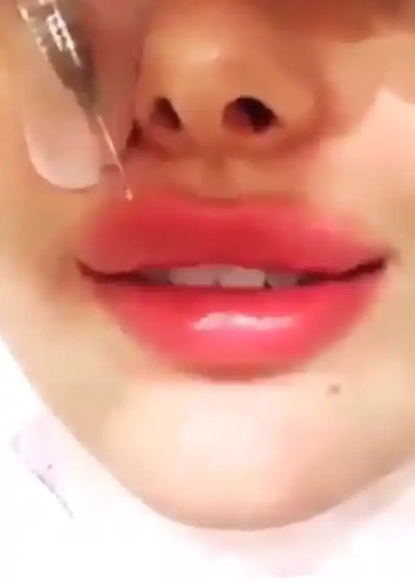 Video Of Kylie Jenner Getting Lip Filler Injections Surfaces [Watch Video, Photos]